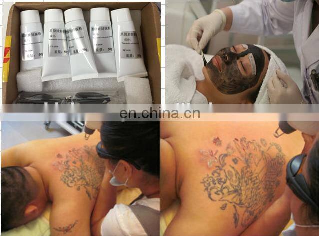 High quality yag laser q switched nd yag laser yag laser diode touch screen beauty equipment