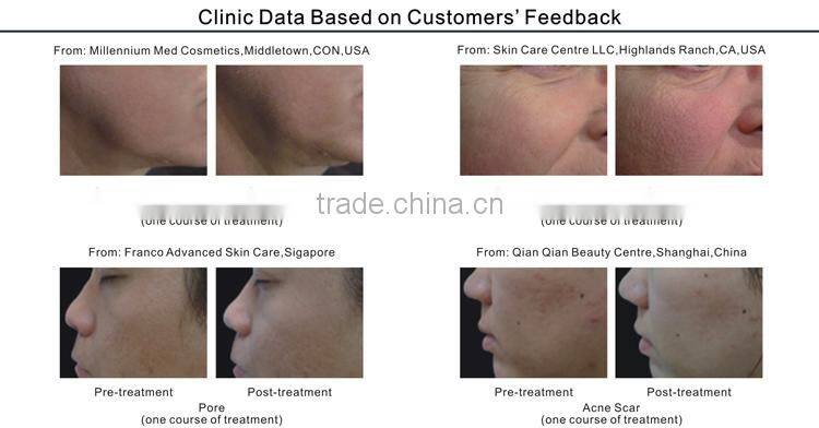 Non Invasive Multi-function Anti-aging Beauty Machine