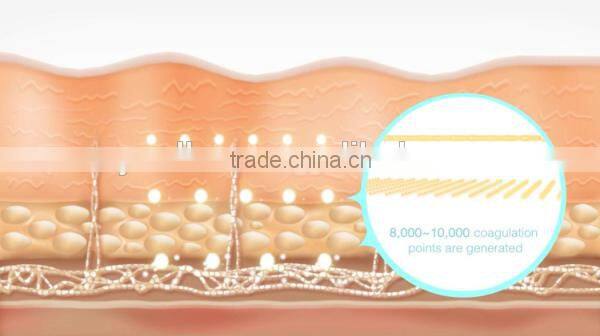 HIFU Facial Beauty Machine for Face lift Brow Lift