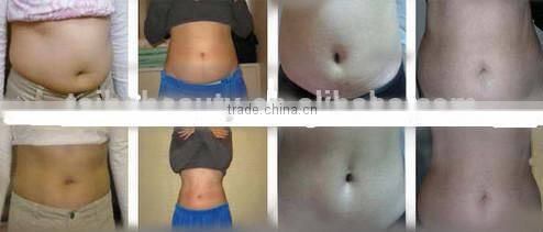 Alibaba China best sale cavitation ultrasonic beauty machine/ Cavitation machine with two rf heads, one vacuum head & cavitation