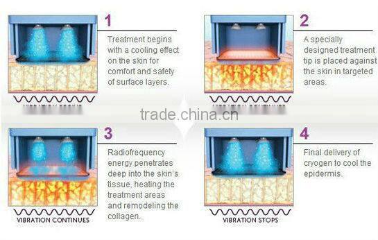 Hot new product for 2014 thermal skin tightening machine