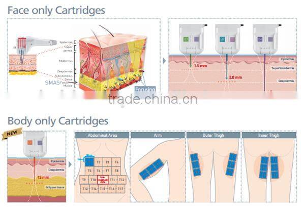 Professional HFU facial contouring best-sale High Intense Focus Ultrasound HFU10