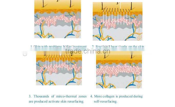 Newest laser co2 fractional medical machine prices skin tightening equipment