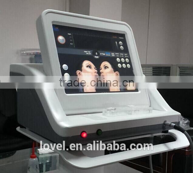 Alibaba trade assurance laser wrinkle removal machine hifu ultrasound face lift machine