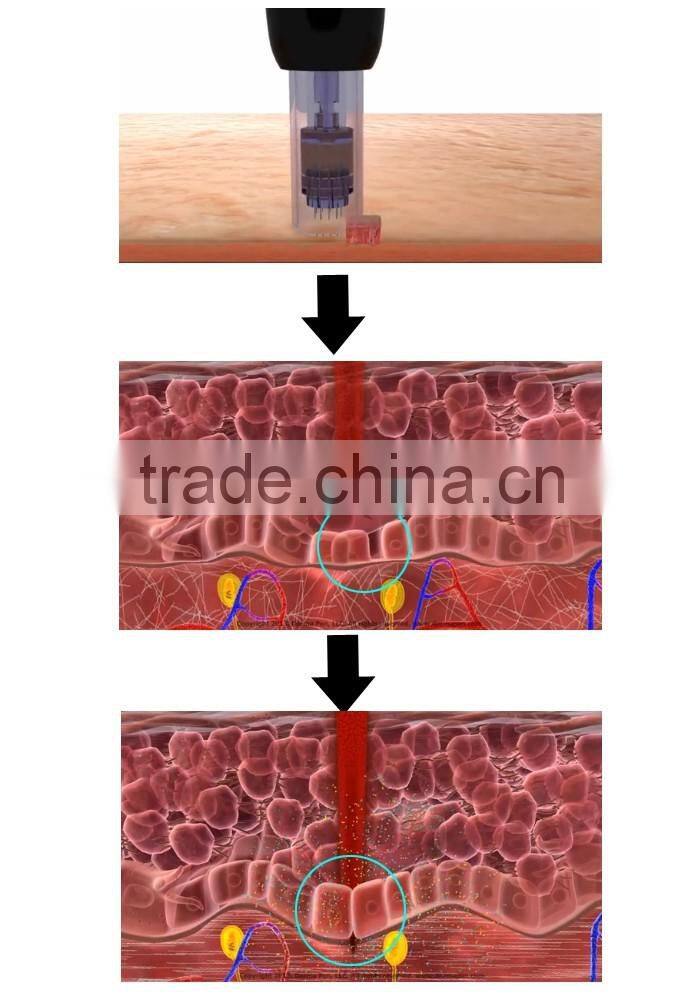 Derma pen Needles