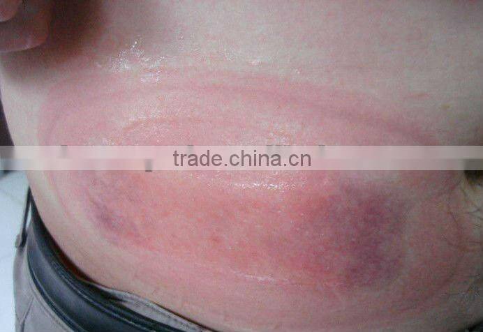 Hot Sale! criolipolisys beauty salon equipment