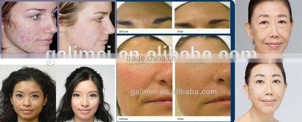 HOT!!! NEW 2 in 1 portable rejuvenation jet peel facial oxygen therapy machine