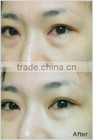 paypal, Japanese high quality CO2 gel face mask for skin care