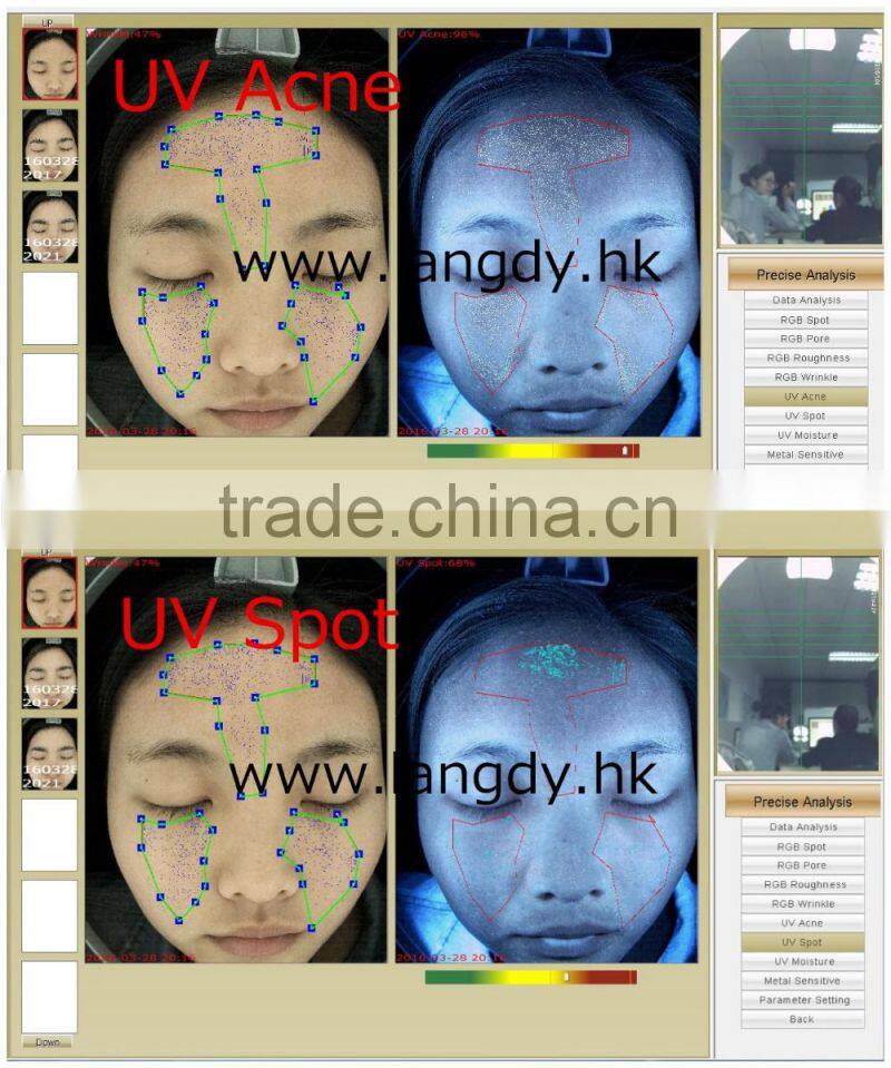 computer vision skin color detection skin oil diagnosis skin care beauty machine