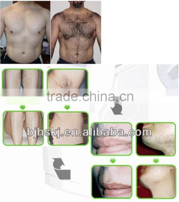 Promotion new technology Clinic use hair removal devices ipl/hair removal shr ipl