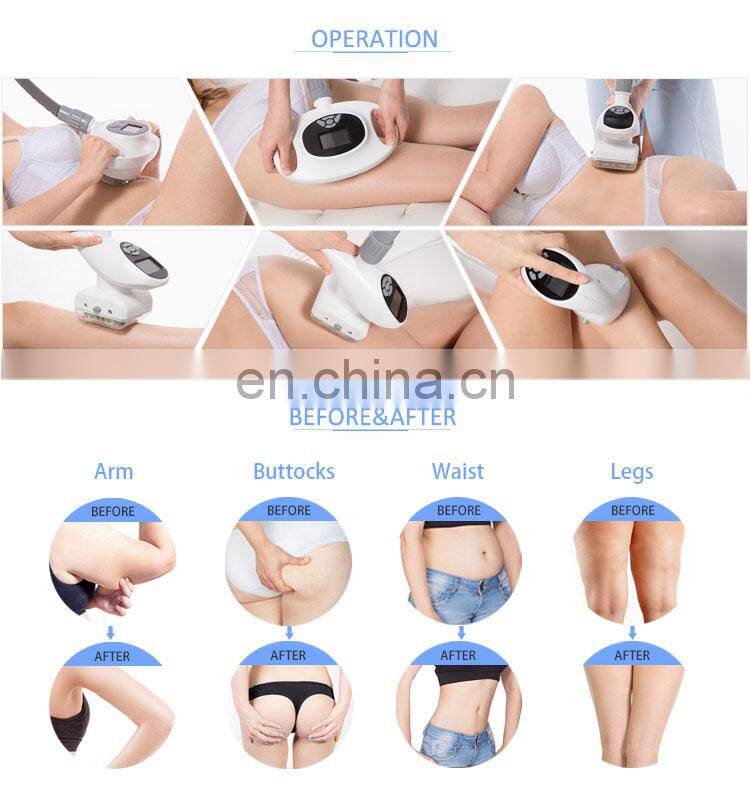 Vertical ultrasonic cavitation vaccum RF roller massage anti cellulite body shaping slimming machine