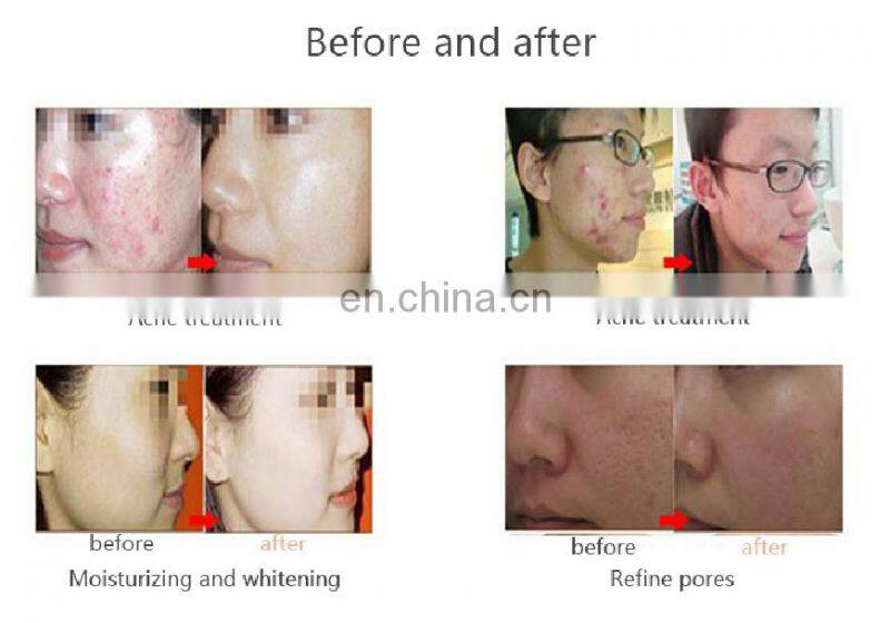 Multifunction aqua oxygen jet peeling skin rejuvenation 7 color led light therapy skin whitening machine