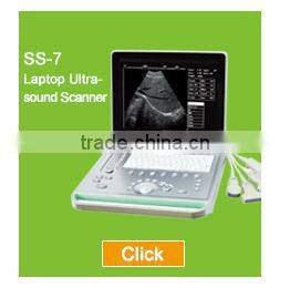 Sonostar good quality handheld portable vet ultrasound scanner pig veterinary ultrasound V6