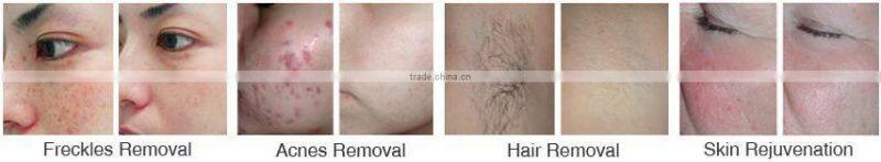 beauty ipl 2014 cheapest ipl machine price/multifunction laser beauty machine/shr ipl rf machine YH-III