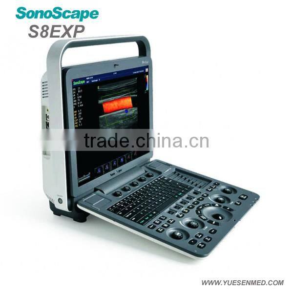 Medical device Color Doppler Portable 4d ultrasound