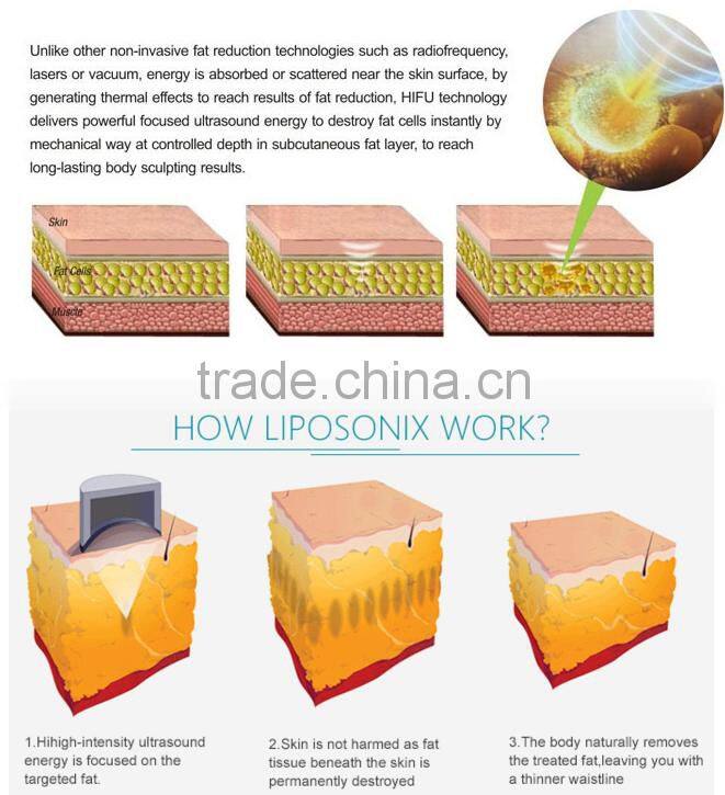 Ultrasound weight loss electronic beauty slimming machine