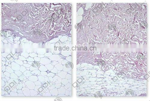 (CE)Most powerful body shaping machine - 4 in 1 ultrasonic rf vacuum lipo laser machine (S10)