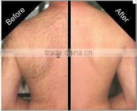 2013Newest IPL technology hair removal never shave or wax again