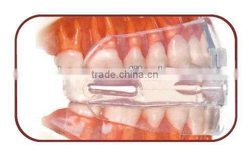 factory produce high quality snore off , snore gone stopper