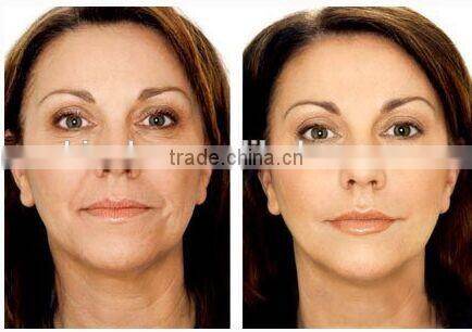 Beauty salon facial skin rejuvenating machine