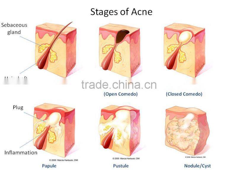 2015 New Products Red Light Therapy led light skin tightening machine