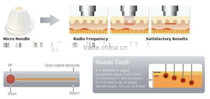 Zhengjia Medical 2014 Newest fractional rf/ fractional rf microneedle/rf fractional micro needle