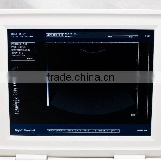 Full Digital Laptop B&W ultrasound system Ultrasound Scanner Ultrasound machine