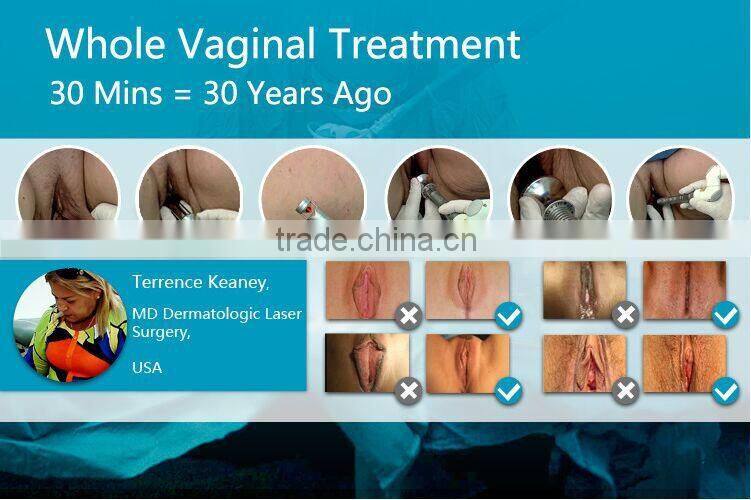 Vertical Fractional Co2 Laser for Vaginal Tightening, Medical Laser Machine