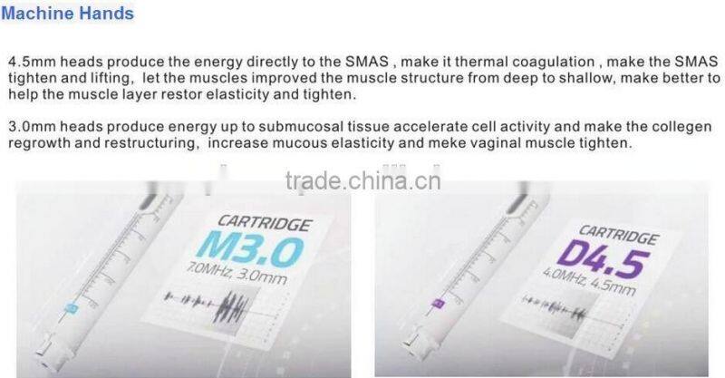 AYJ-SS09 ayplus ultrasound hifu machine vaginal