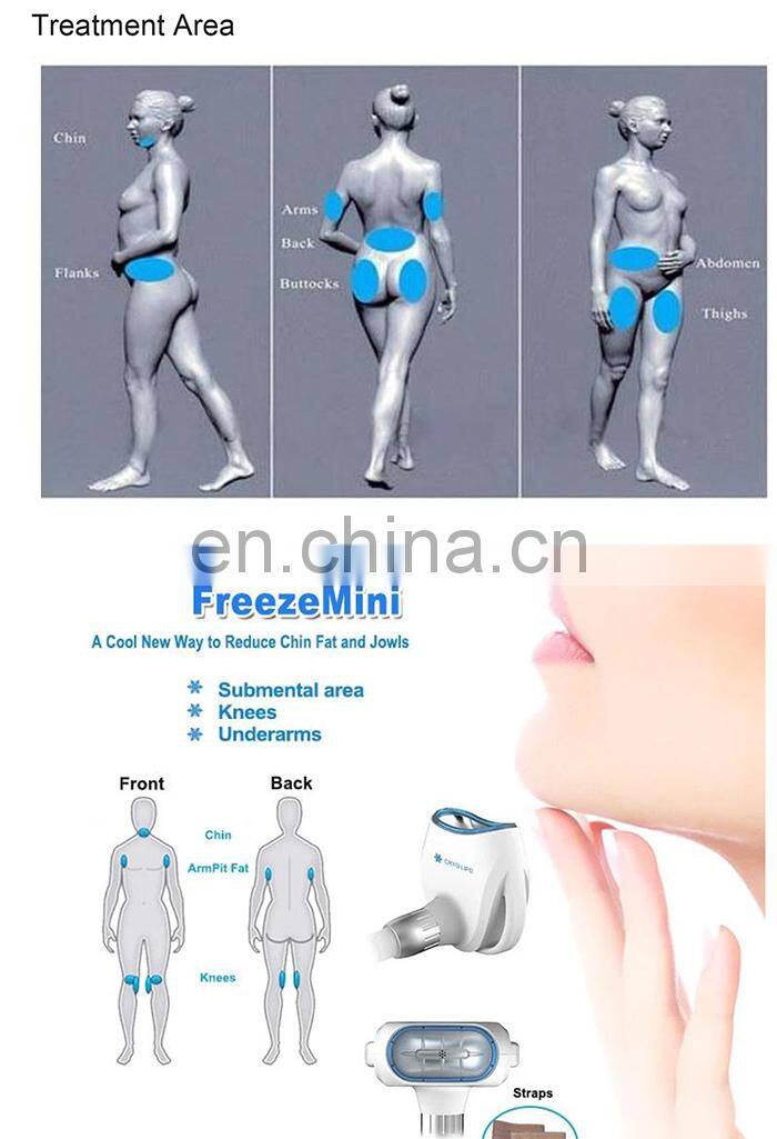 Newest 2 cryo handle Vacuum fat freezing weight loss lipo laser shape slimming machine
