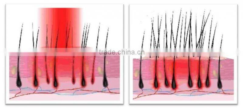 PDT Led Laser Diode Hair Regrowth Machine For Hair Lossing