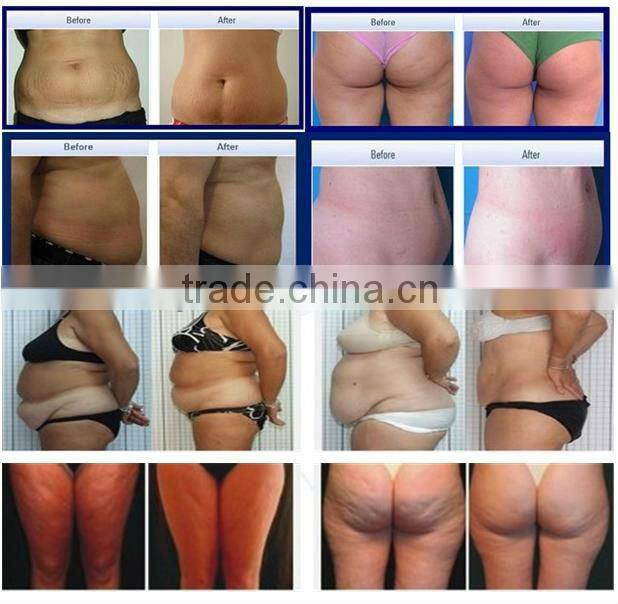 Professional ultrasound cavitation slimming gel with CE
