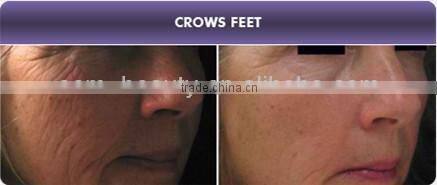 12 needles Mini automatic Microneedle Skin Needling