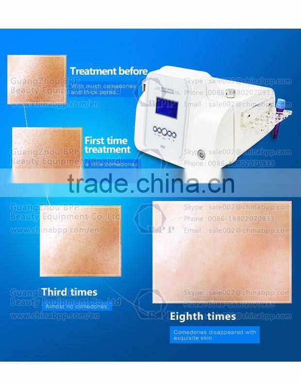 Beauty salon skin peeling diamond tips for hydro dermabrasion water oxygen jet peel machine