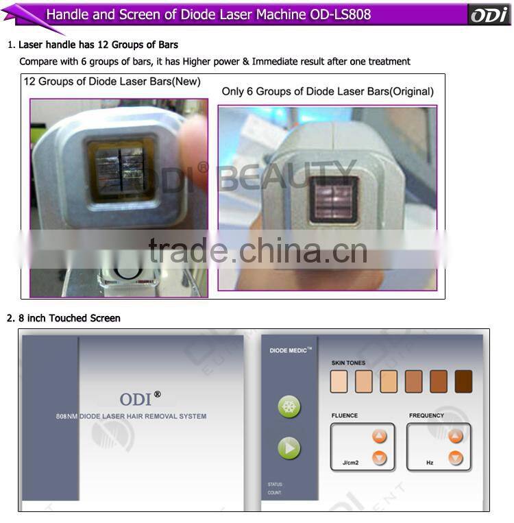 OD-LS808 Best selling hot painless depilation 808 diode laser machine