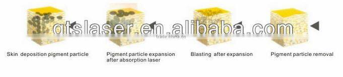 high power medical CE approval Grand q switched nd yag laser tattoo removal machine