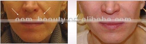 Professional Multifunction Elight Machine