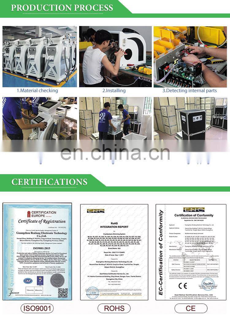 epilator home laser hair removal handheld 808nm diode laser hair removal machine at home