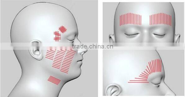 portable RF face lift machine/best rf skin tightening face lifting machine