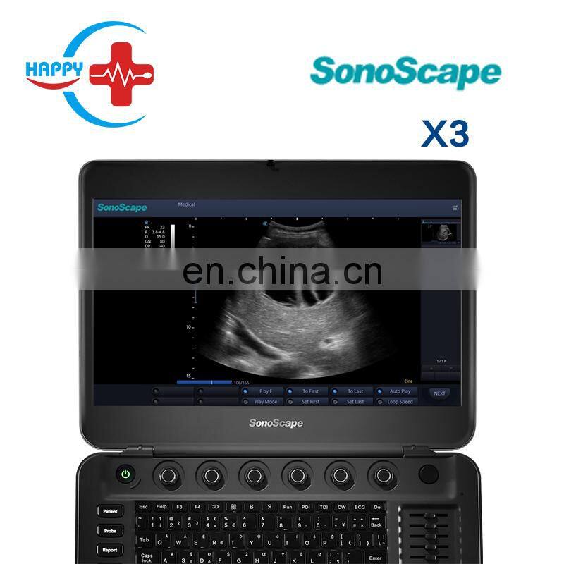 Cheap medical Sonoscape x3 ultrasound machine/Laptop ultrasound scanner/Portable ultrasound probe