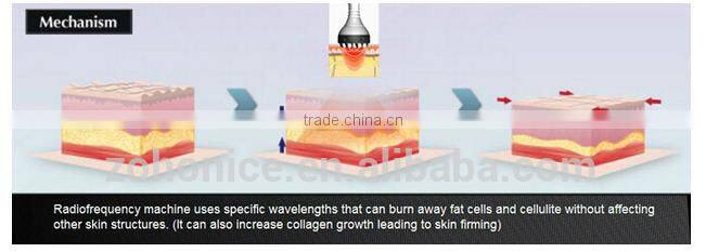 BD06C 2016 new vacuum RF roller +ultrasonic cavitation infrared laser weight loss slimming machine