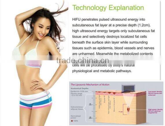 LS08-laura HOT sale Ultrashape / Liposonix / HIFU Slimming Machine