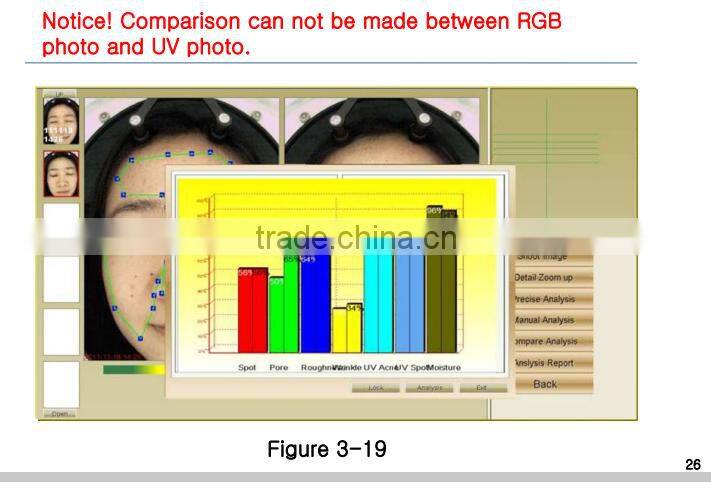 3D facial skin analyzer scanner dialysis machine analyzer machine