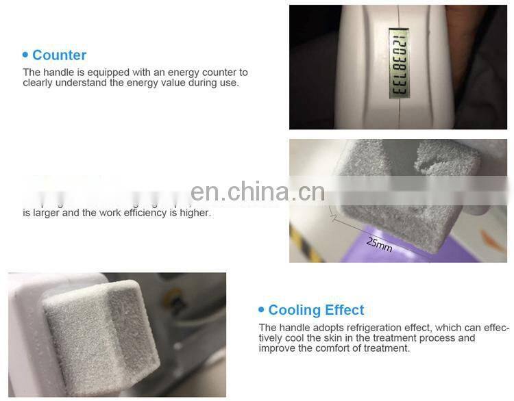 Newest painless hair removal 808nm diode laser