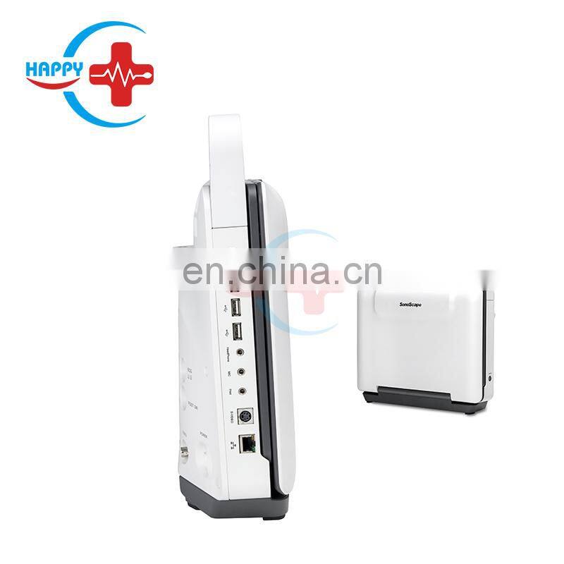 SonoScape E1 Portable Color doppler Ultrasound with 3 probe connector/SonoScape E1 EXP