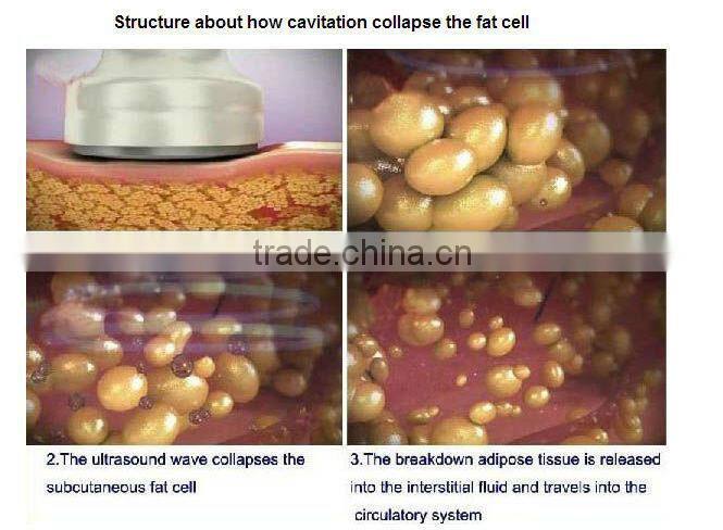 BS02 Portable 5 in 1 RF+vacuum 40k cavitation slimming machine