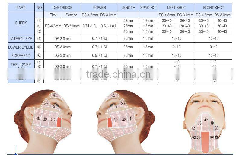 Portable hifu 40000 shots face lift ultrasound machine and wrinkle removal device