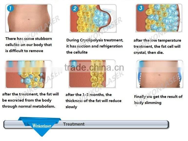 2016 new design! the latest cryolipolysis body slimming and fat reduction machine