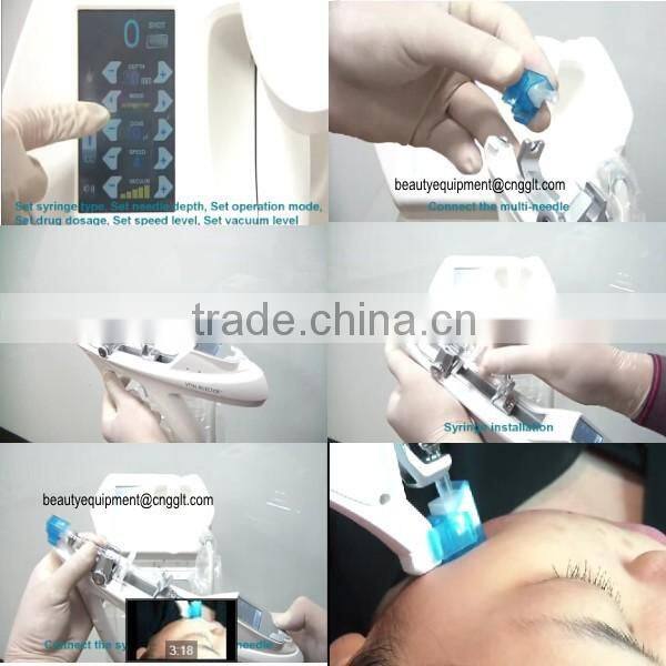 Mesotherapy machine wrinkle remover