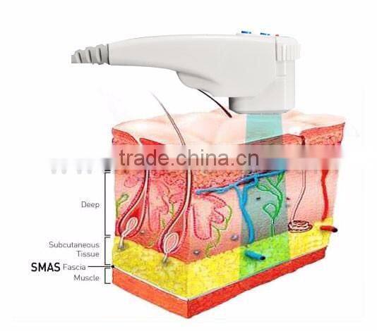 hot shaping machineultrasonic blackhead remover cellulite reduction liposonix